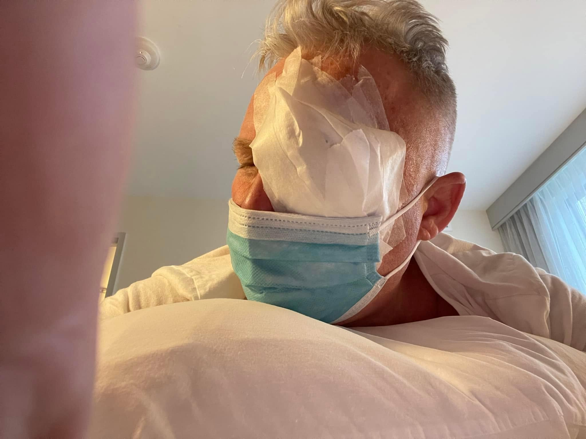 Michael recovering with his right eye bandaged after retinal surgery