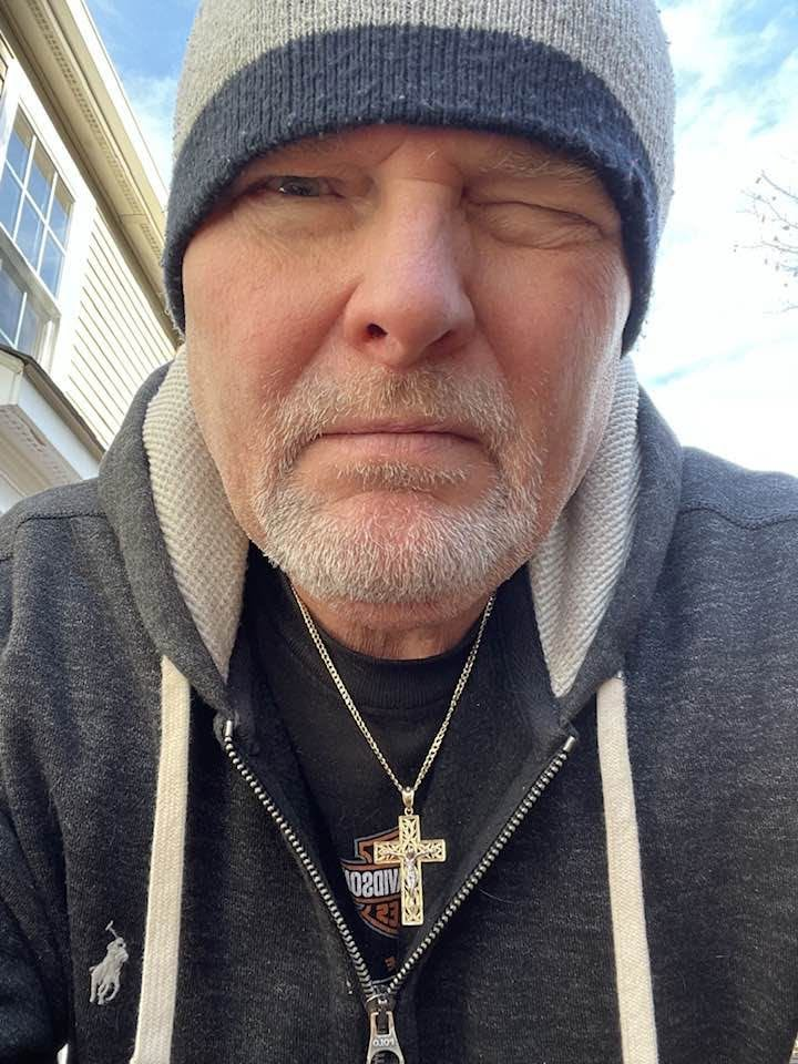 Michael healing after his second failed retinal surgery
